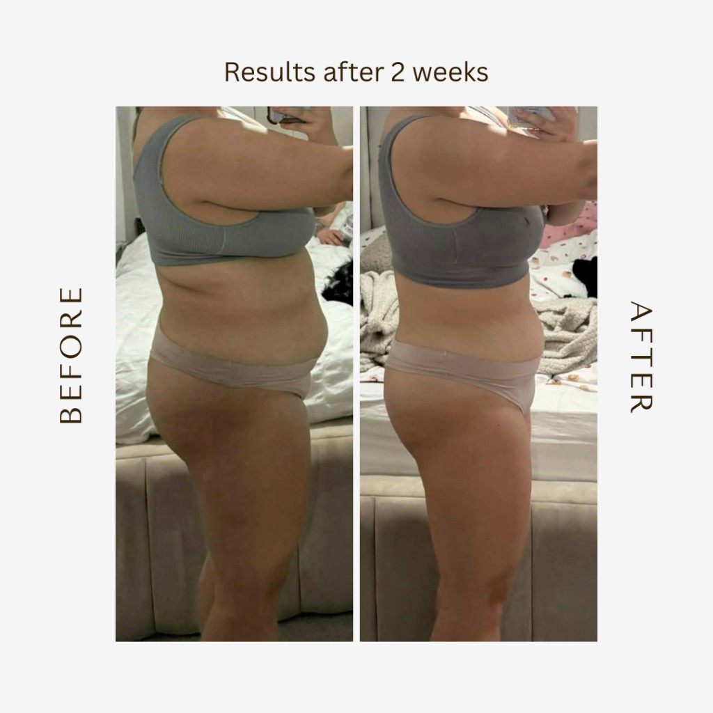 Before and after results after 2 weeks