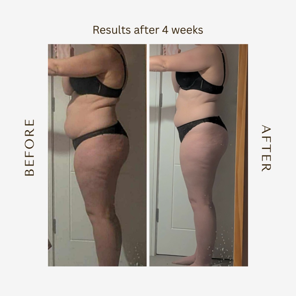 Before and after results after 4 weeks