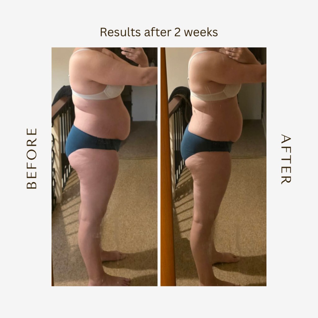 Before and after results after 2 weeks