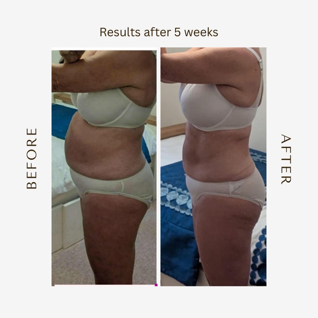 Before and after results after 5 weeks