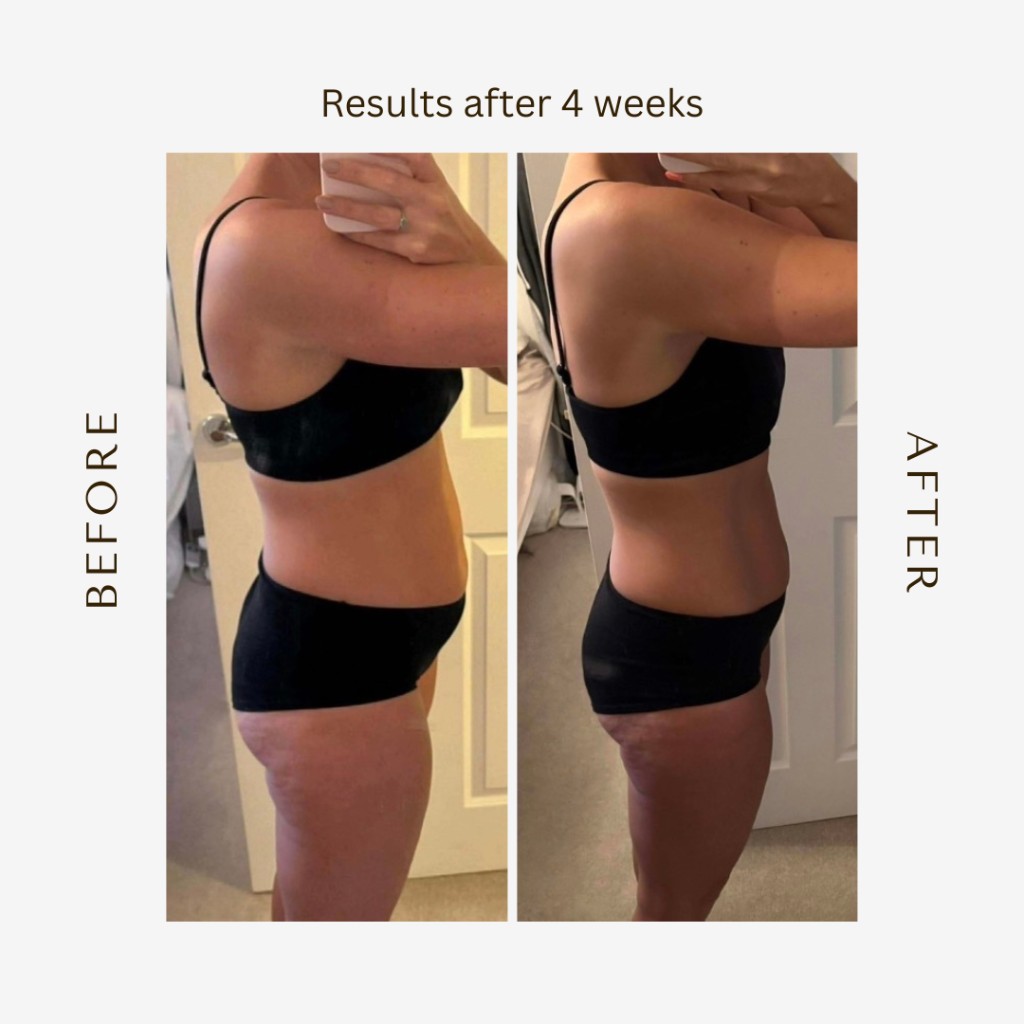 Before and after results after 4 weeks