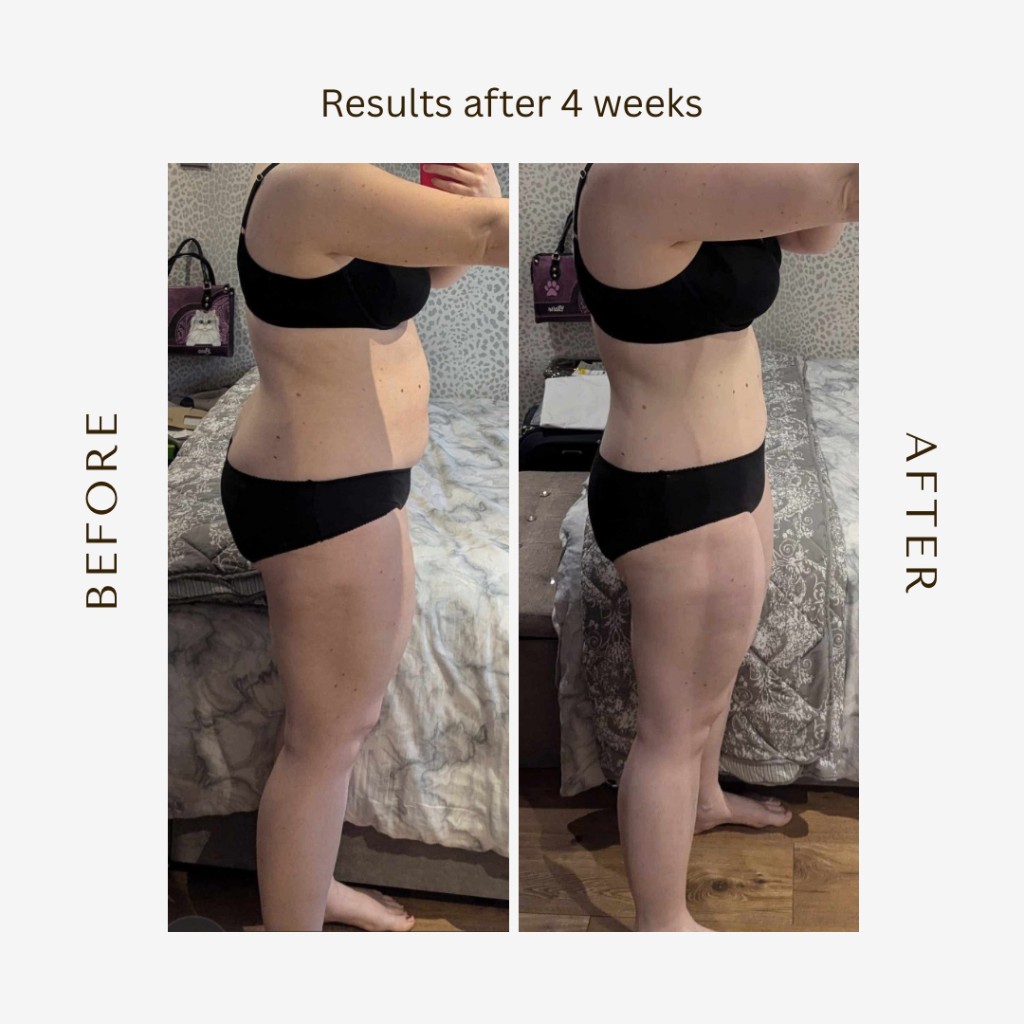 Before and after results after 4 weeks